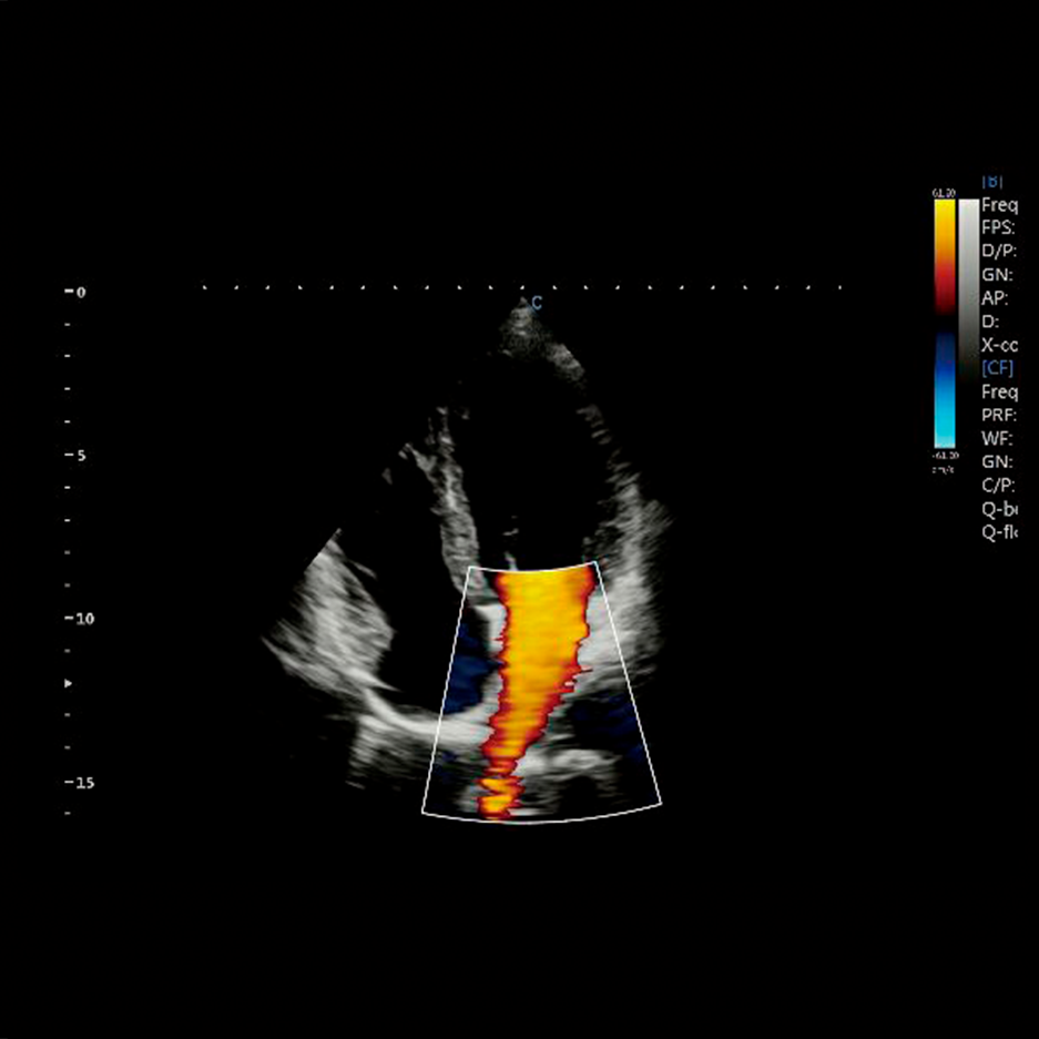 XBit cardiac MC
